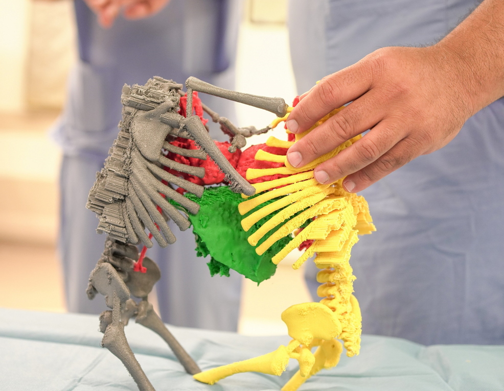 CEZAYİRLİ YAPIŞIK İKİZLER TÜRKİYE’DE 9 SAAT SÜREN BİR OPERASYONLA KENDİ BEDENLERİNE KAVUŞTULAR