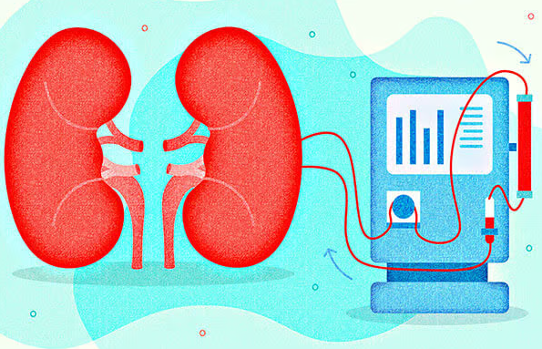 Hemodiyaliz Nedir Kısaca?