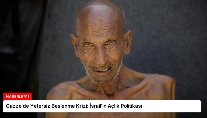 Gazze’de Yetersiz Beslenme Krizi: İsrail’in Açlık Politikası